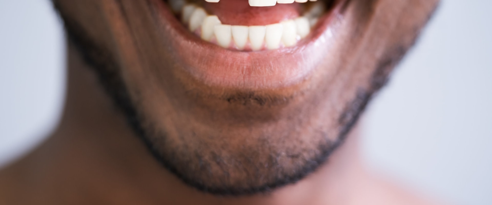 What to Do When You Have a Knocked-Out Tooth