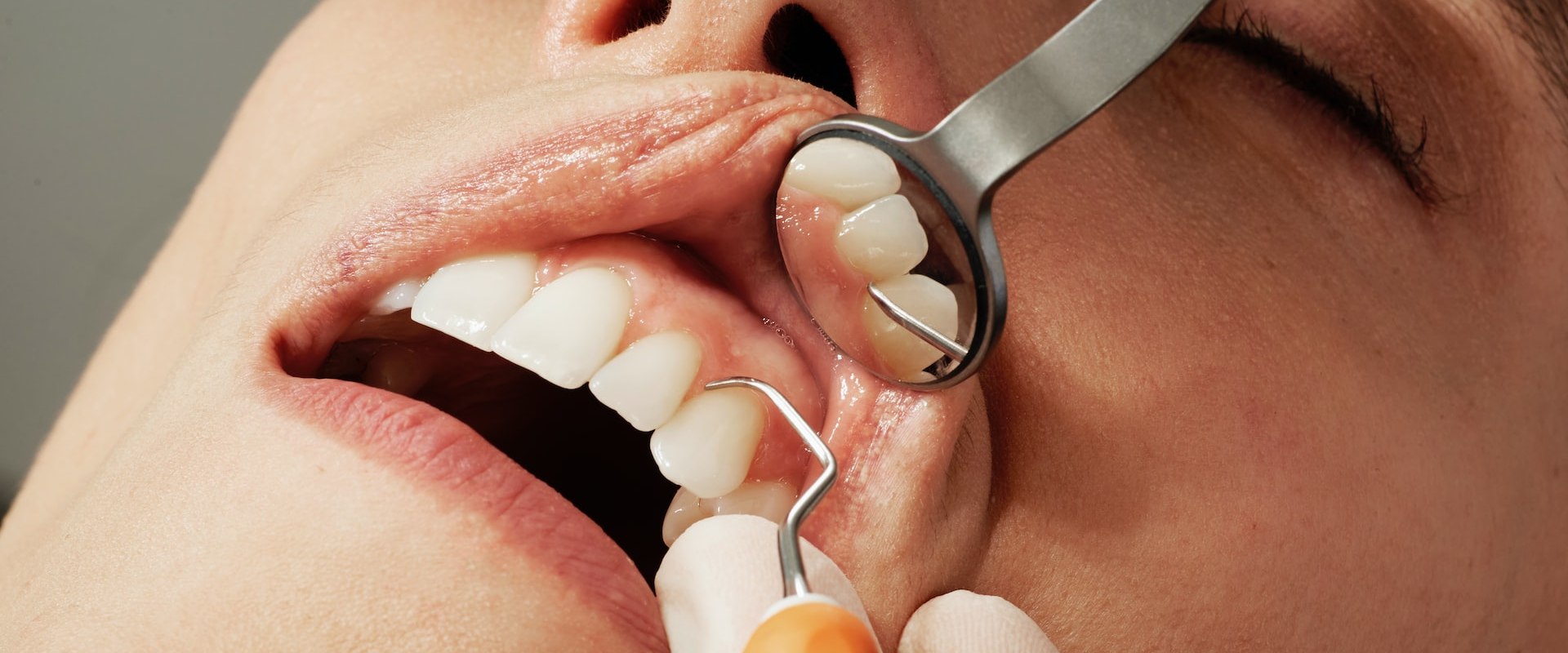 What is the Difference Between an Emergency Dentist and a Regular Dentist?