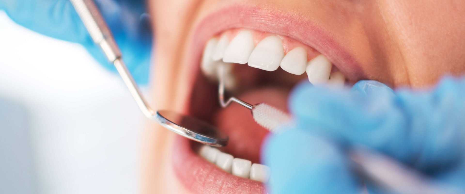 What Can You Use as an Emergency Filling?