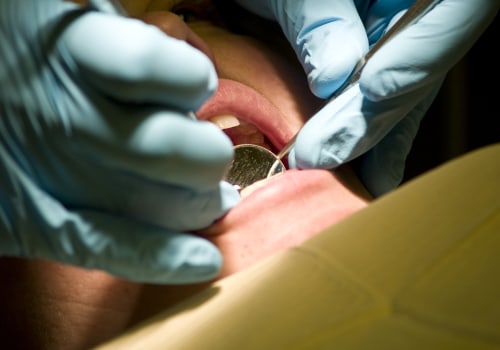 Do Emergency Dentists Perform Root Canals?