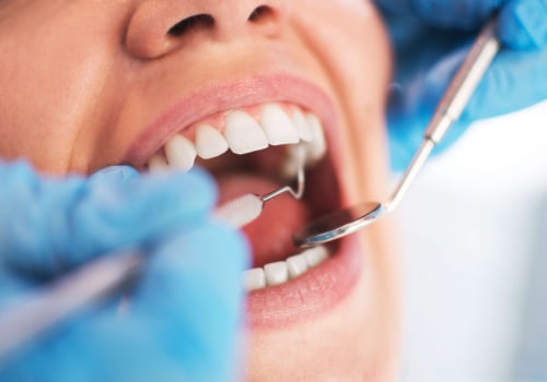 What Can You Use as an Emergency Filling?